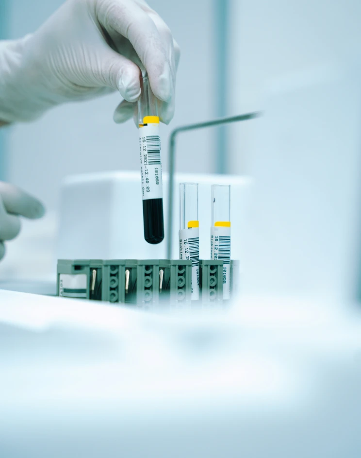 Epigenetische Alterungstests Preis